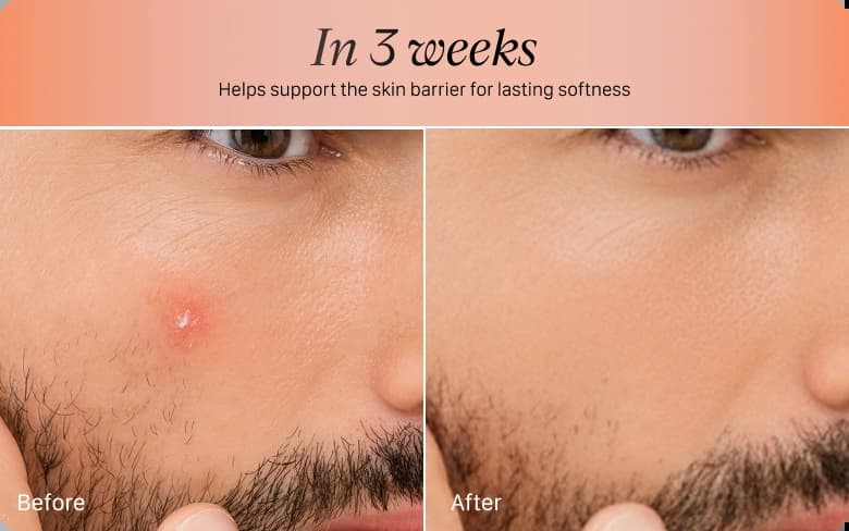 skin novera products